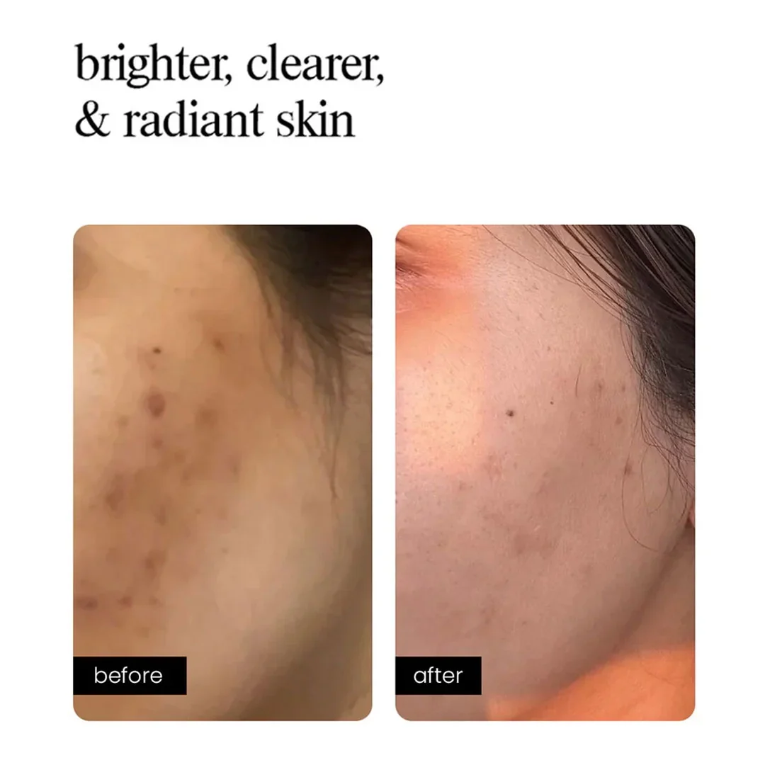 AMINU - Correcting Concentrate 10ml - Image 3